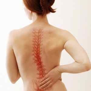 Хвороби спини: симптоми і як називаються захворювання попереку | Ревматолог
