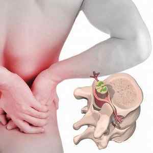 Хвороби спини: симптоми і як називаються захворювання попереку | Ревматолог