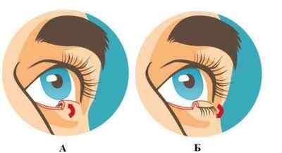 Хвороби століття очей (нижнього і верхнього): опис захворювань у людини, симптоми, лікування
