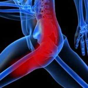 Хвороби тазостегнового суглоба: симптоми і лікування у жінок і чоловіків, уколи і таблетки, вправи і ознаки запалення | Ревматолог