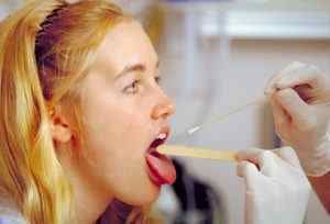 Кандидоз порожнини рота: симптоми і лікування