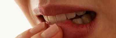 Кандидоз порожнини рота у дорослих і дітей: симптоми, лікування, фото і дієта