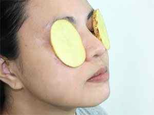 Картопляна маска для очей, сира картопля від синців