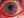 Кератопатія рогівки ока: лікування, види (бульозна, стрічкоподібна, точкова)