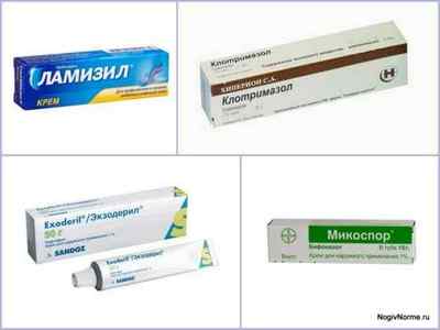 Кетоконазол таблетки і мазь (крем) від грибка: інструкція із застосування, ціна, відгуки, аналоги
