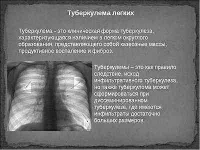 Клінічна класифікація туберкульозу легенів
