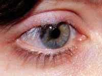 Колобома райдужки ока (вроджена і набута): як діагностувати, лікування зорового нерва