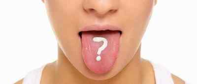 Кондиломи на мові і в роті: видалення і лікування