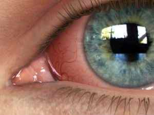 Конюнктива ока: що це таке, симптоми і лікування патологій