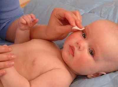 Конюнктивіт у новонароджених: чим лікувати у немовлят, лікування в домашніх умовах