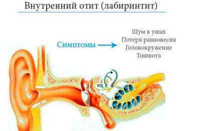 Краплі Гидрокортизон в вуха: інструкція із застосування