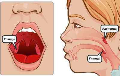 Краплі і спрей для носа Квікс: інструкція із застосування