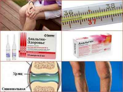 Кращі ліки від артрозу суглобів - препарати для лікування (таблетки, мазі, уколи)