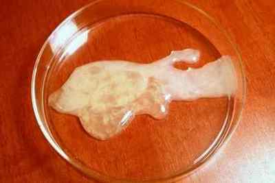 Кріоконсервація (заморозка) сперми: чи можливо це