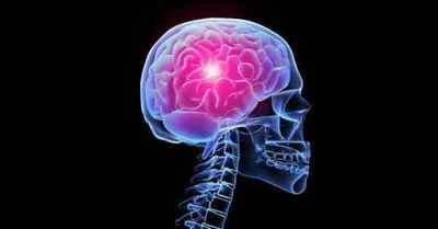 Кіста пінеальною (шишкоподібної) залози головного мозку: симптоми і наслідки