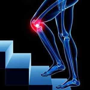 КТ колінного суглоба: що показує компютерна томографія кісток і суглобів коліна, що краще КТ або МРТ і чим відрізняється | Ревматолог