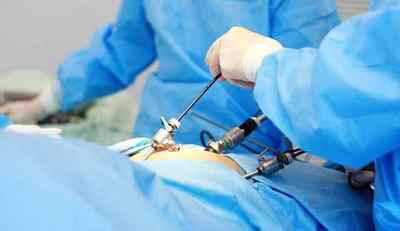 Лапароскопія маткових труб: операція і її проведення