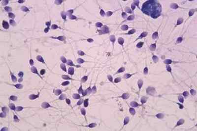Лецитинові зерна в спермограмме: значення і норма
