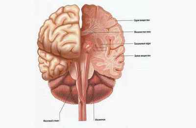 Лейкоареоз головного мозку перивентрикулярний, симптоми і лікування