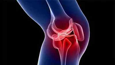 Лігаментоз колінного суглоба: що це таке, симптоми і лікування хрестоподібних звязок | Ревматолог