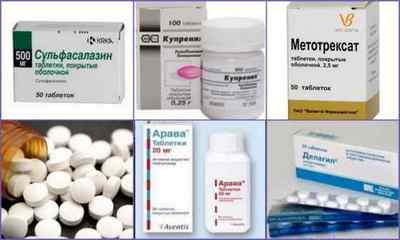 Ліки від артриту суглобів - лікування сучасними медикаментами, список ефективних препаратів