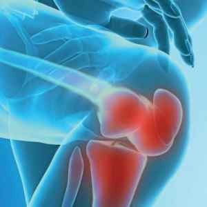 Ліки від артрозу суглобів: таблетки і препарати, медикаментозне лікування колінного суглоба, кращі засоби | Ревматолог