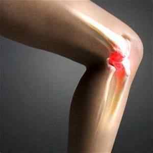 Ліки від артрозу суглобів: таблетки і препарати, медикаментозне лікування колінного суглоба, кращі засоби | Ревматолог