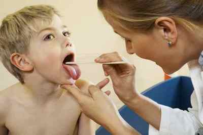 Лікування ангіни у дітей, симптоми, терапія, антибіотики