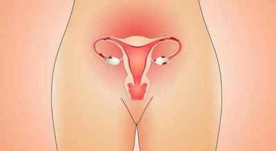Лікування ендометріозу матки у жінок