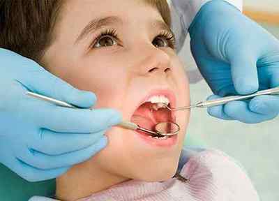 Лікування карієсу молочних зубів у дітей раннього віку - профілактика