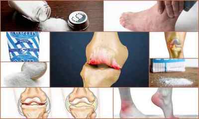 Лікування суглобів сіллю: рецепти сольових повязок, компресів, ванн та інших процедур, відгуки