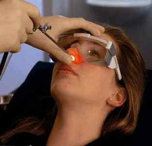 Лікування вазомоторного риніту лазером - лазеротерапія носа
