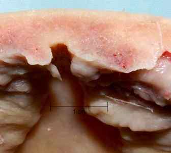 Лобова кістка - анатомія, травми і захворювання