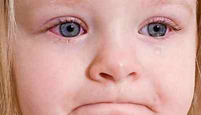 Лопнула судина в оці у дитини: причини, чому лопаються капіляри у немовлят