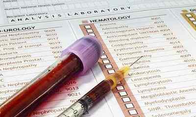 Маркери вірусних гепатитів В і С: здача аналізу, розшифровка