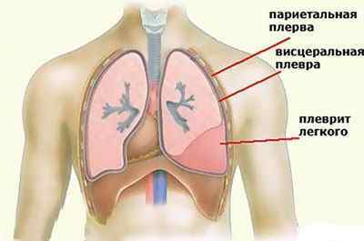 Масаж при пневмонії (запаленні легенів) у дітей і дорослих