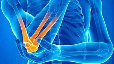 Мазі і гелі для лікування артрозу колінного суглоба: знеболюючі і зігріваючі крему з назвами | Ревматолог