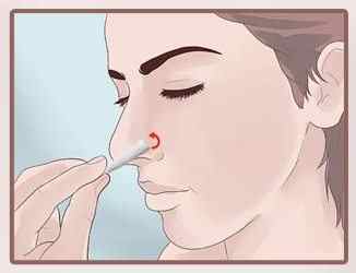 Мазь Розенфельда: інструкція із застосування в ніс