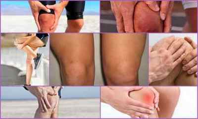 Меніскопатія колінного суглоба: причини, симптоми, діагностика, лікування