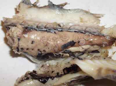 Метагонімоз: фото збудника кишкового трематода у людини в організмі
