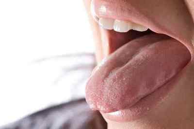 Металевий присмак у роті у чоловіків: причини і лікування