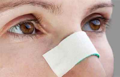 Методи позбавлення від гематоми носової перегородки