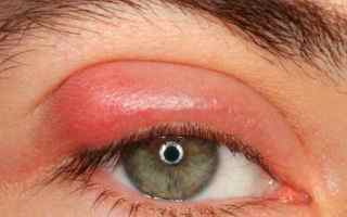 Метронідазол краплі очні: застосування розчину і лікування