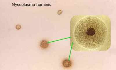 Мікоплазма хомініс: шляхи зараження, способи лікування