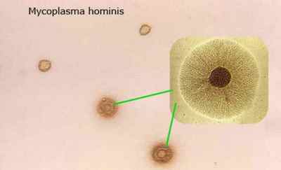 Мікоплазма наслідки: коли і які характерні