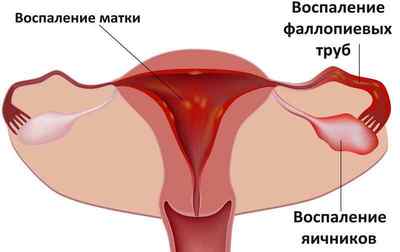 Мікоплазма наслідки: коли і які характерні