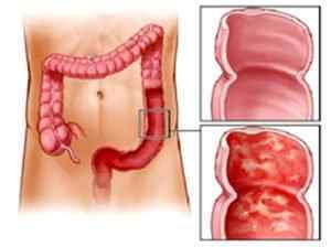 Мікробіота кишечника: визначення, функції та перевірка стану