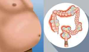 Мікробіота кишечника: визначення, функції та перевірка стану