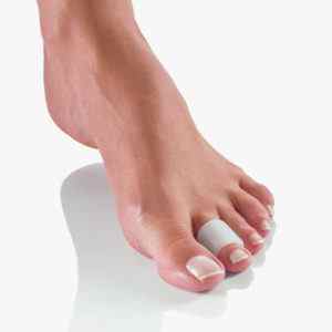 Молоткообразние пальці на ногах: лікування молоткообразной деформації пальців стопи без операції народними засобами | Ревматолог