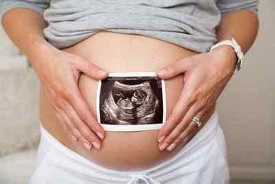 Міома при вагітності - відгуки пацієнток